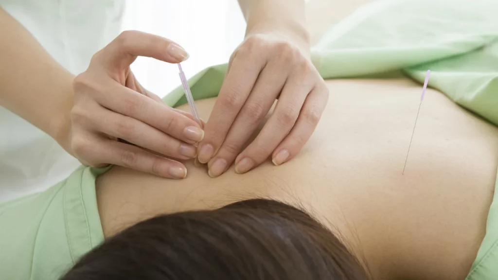 ¿Quién dirigió este estudio de control del dolor con la ayuda de la acupuntura?