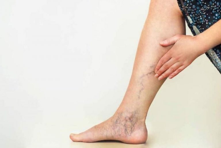 Esta posición provoca el problema crónico de várices