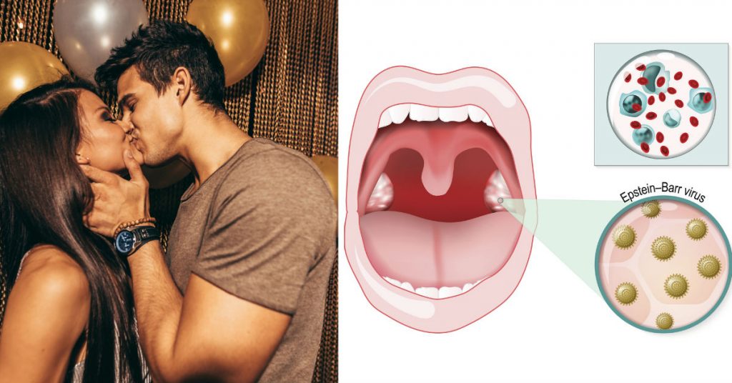 ¿Todo lo que trasmite un beso es bueno?