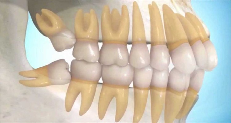 Estos son los defectos del cuerpo humano