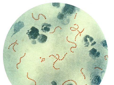 Qué es la fagocitosis 1 Qué es la fagocitosis