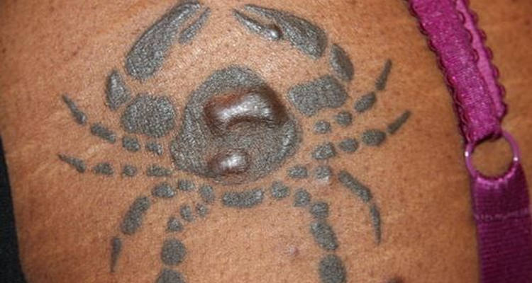 Las reacciones que tiene tu cuerpo cuando te realizas un tatuaje