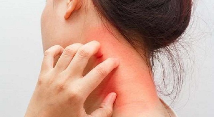 10 señales que da el cuerpo cuando tu hígado está por colapsar