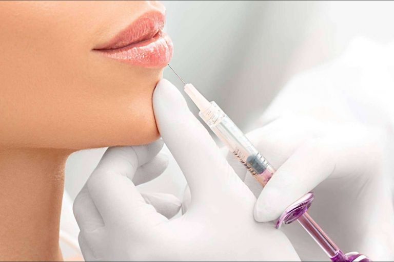 Aumento de labios en Barcelona de la mano del Dr. Carlos Zito