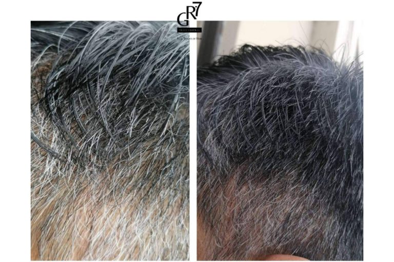 Las causas de la aparición de las canas y la manera de revertirlas de la mano de GR-7 Professional