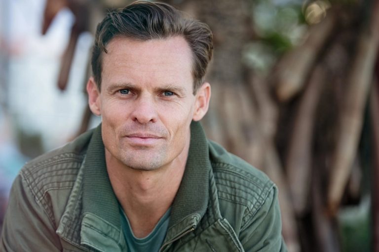 Consejos para encontrar la mejor clínica de implante capilar en Madrid