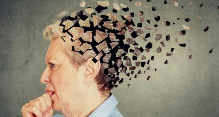 El ejercicio que detecta si tienes los primeros síntomas del Alzheimer