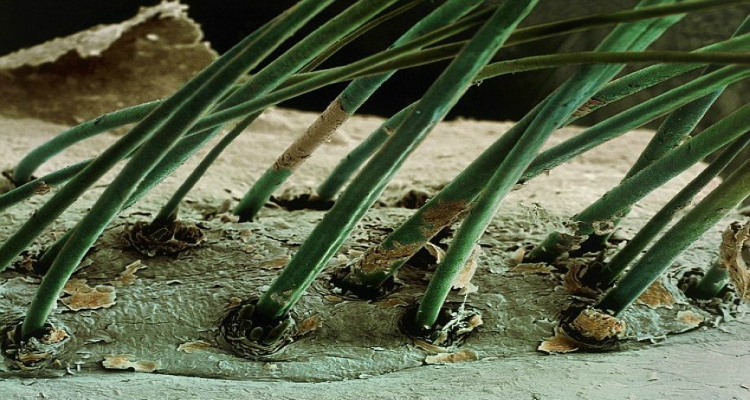 Cosas alucinantes vistas bajo un microscopio