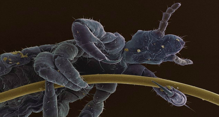 Cosas alucinantes vistas bajo un microscopio
