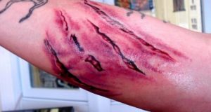 Las reacciones que tiene tu cuerpo cuando te realizas un tatuaje