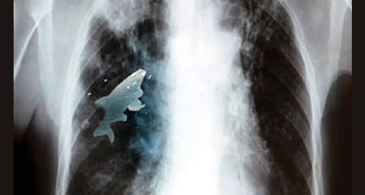 Parásitos que ahora están en tu cuerpo y no lo sabes