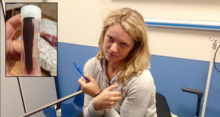 Parásitos que ahora están en tu cuerpo y no lo sabes