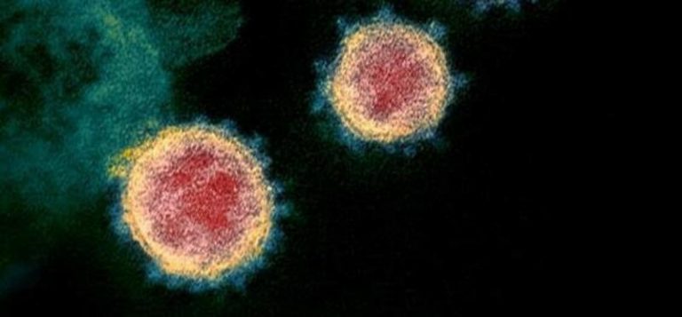 Un estudio analiza cómo los efectos en el cerebro del coronavirus pueden producir COVID-19 persistente