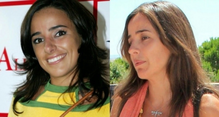 El top de las mejores rinoplastias de famosas españolas