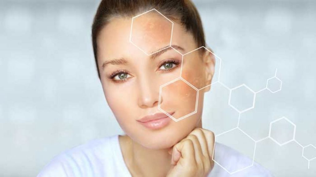 Cómo eliminar las manchas solares de la piel 71 ¿Cuál es la causa de esas molestas manchas solares?