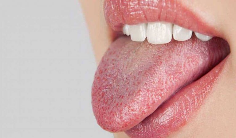 Por qué tienes la boca seca al dormir