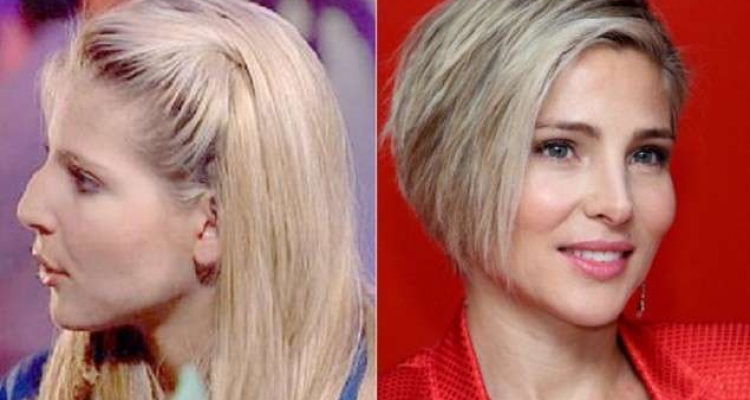 El top de las mejores rinoplastias de famosas españolas