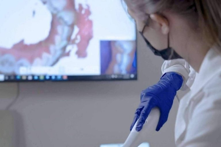 Adquirir una Sonrisa Hollywood gracias a la tecnología digital de Dentinova