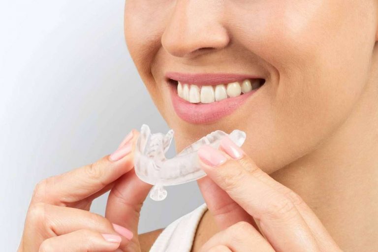 Bruxistop, la férula dental para aliviar los efectos adversos del bruxismo