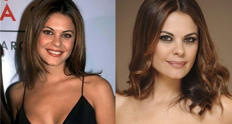 El top de las mejores rinoplastias de famosas españolas