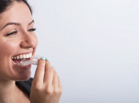 ortodoncia invisible