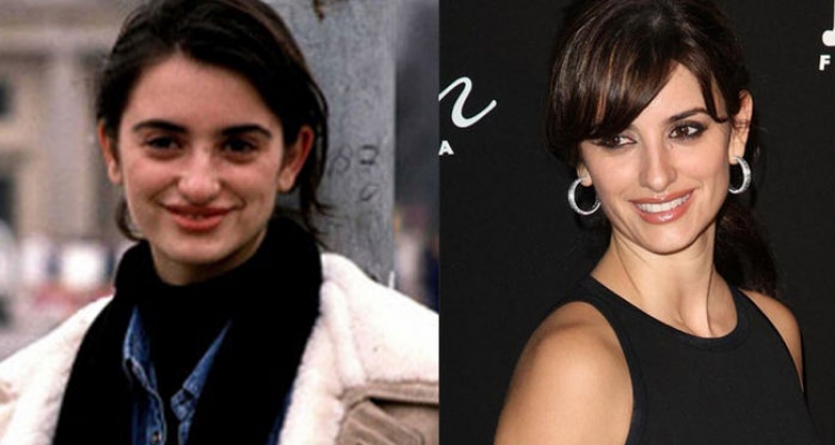 El top de las mejores rinoplastias de famosas españolas