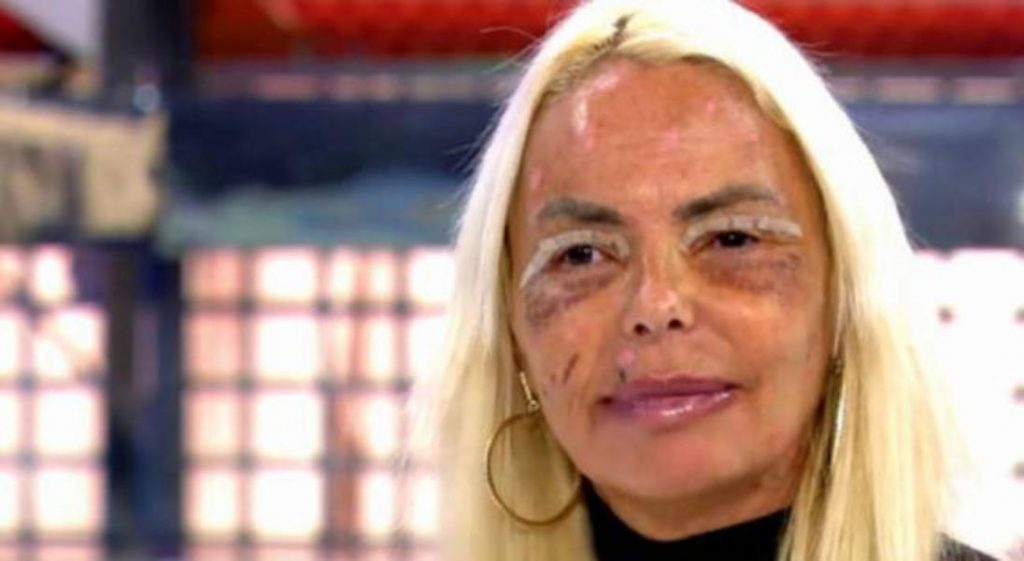 Leticia Sabater: así era antes de sus operaciones estéticas 34 Blefaroplastia y dentadura nueva
