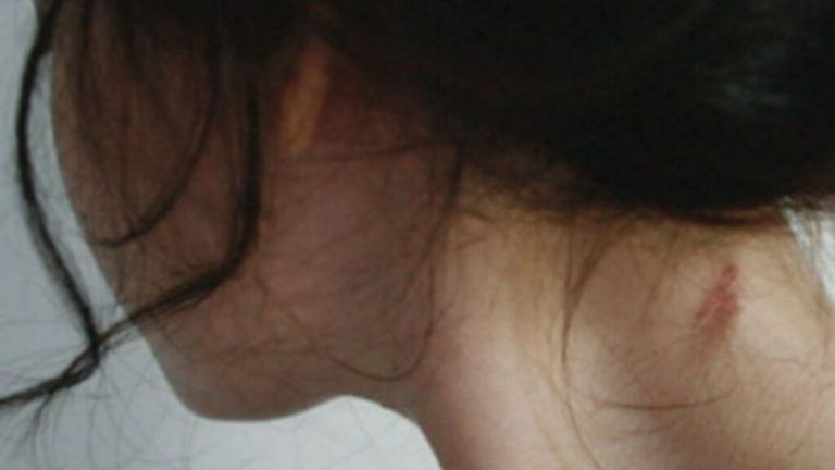 Cómo disimular un chupetón en el cuello