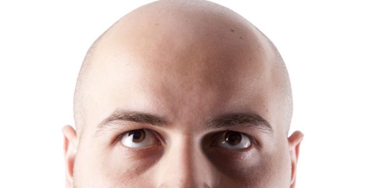 Este medicamento evitará que te quedes calvo