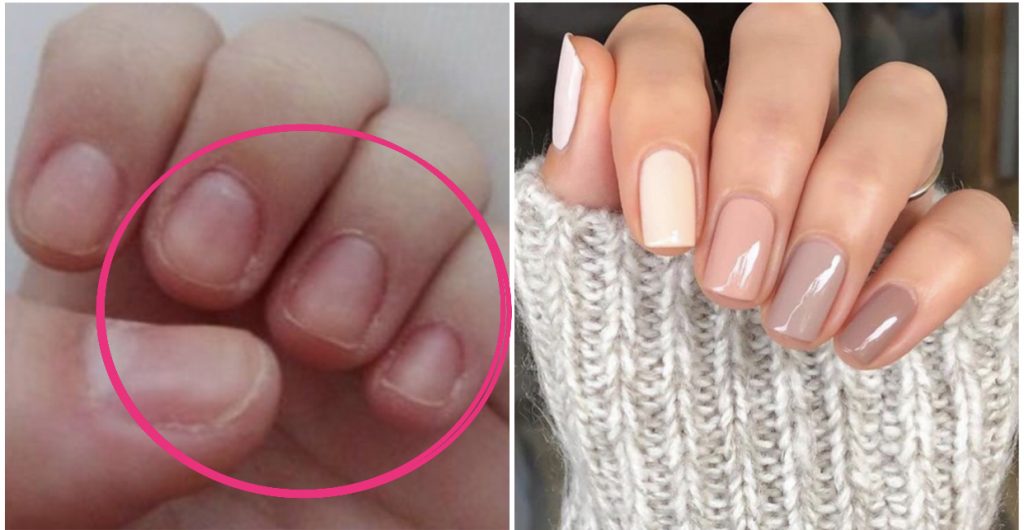 Frótate las uñas y los dedos con guindillas