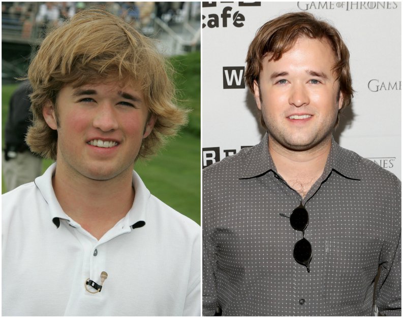 Famosos que pasaron de guapos a feos