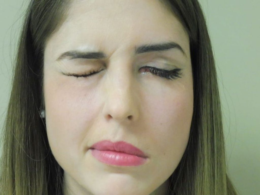 Alguna alteración en el sistema nervioso