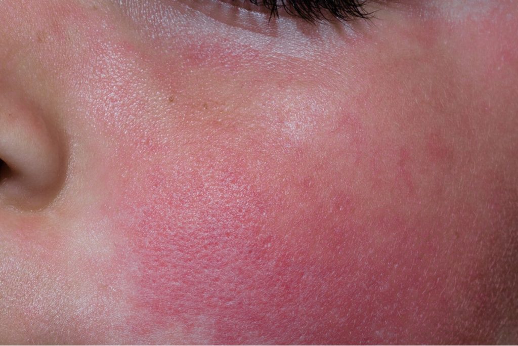 ¿Cuáles son los factores de riesgo?