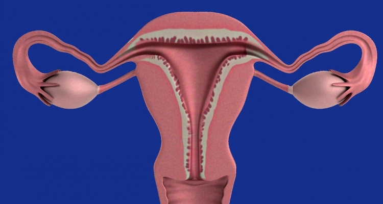 Síntomas de que puedes tener cáncer de ovario