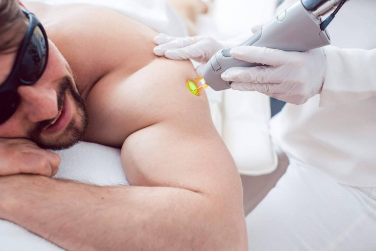 Dermativa, ¿Cuántas sesiones de láser se necesitan para eliminar el vello?