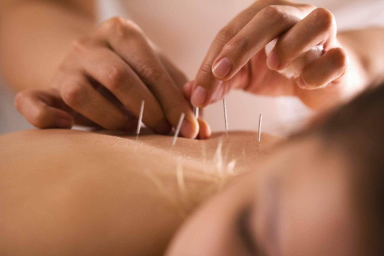 Trabajar de osteópata y acupuntor con formación internacional profesional