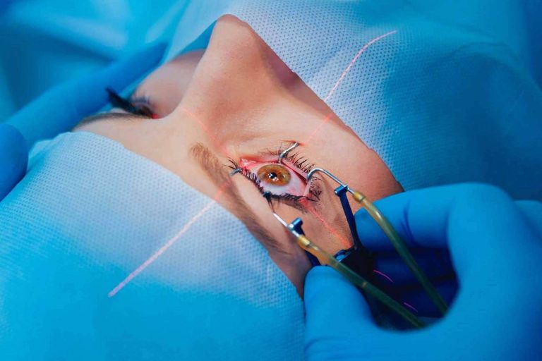 ¿Cuáles son las ventajas de someterse a la cirugía refractiva?