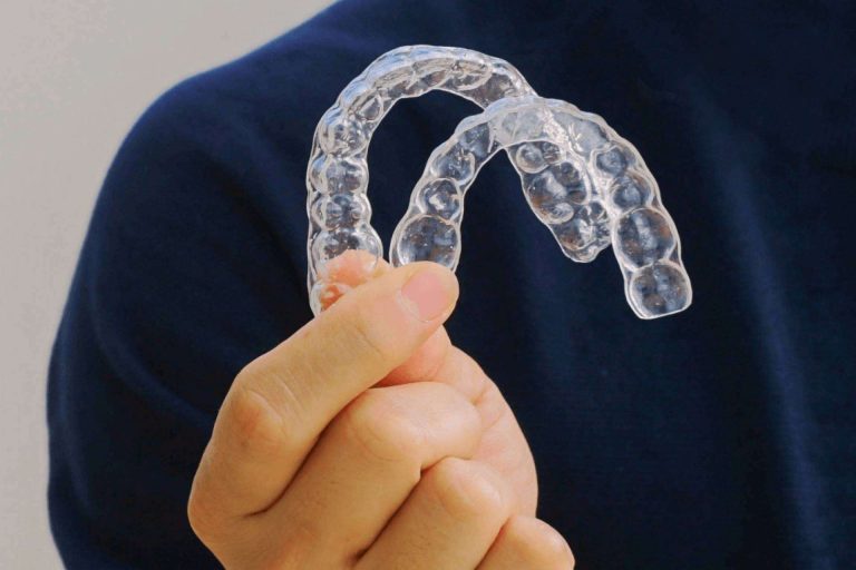 Corporación Dental ofrece un presupuesto y un diagnóstico previo para saber el precio Invisalign