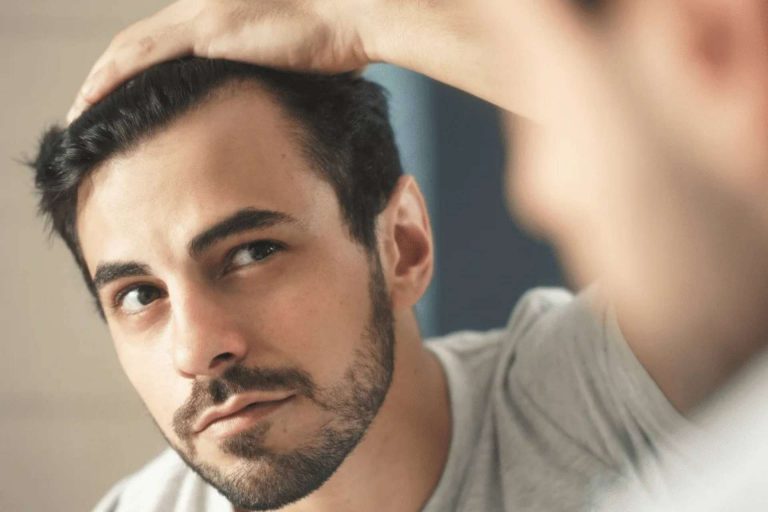 Microinjerto capilar en Madrid de la mano del Dr. Antonio Fernández Brito en Microcapilar Hair Clinic