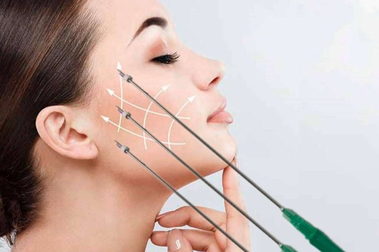 Clínica Zero ofrece combatir la flacidez con los hilos tensores