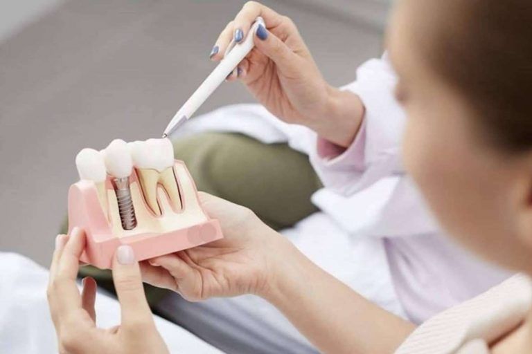 ¿Por qué masticar alimentos supone un gran reto para algunas personas?