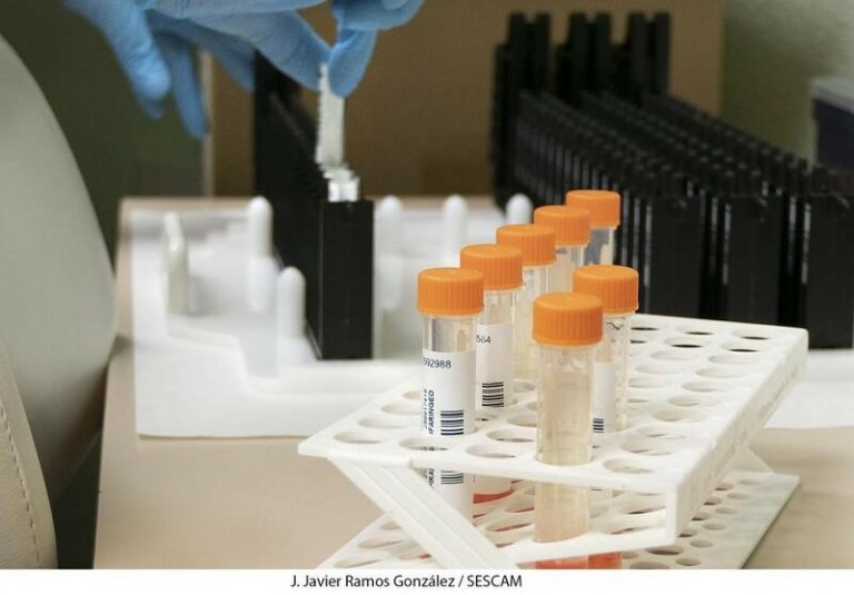 Mas-Coma (OMS), cree que pronto se declarará la pandemia de viruela del mono