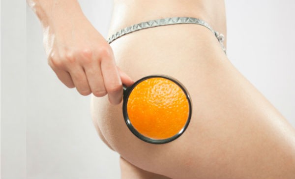 Celulitis: esta es la forma más efectiva de eliminarla