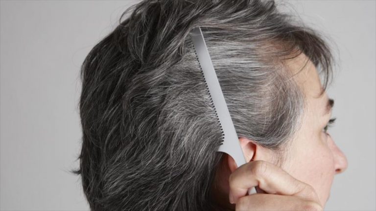 El medicamento que fulmina las canas para siempre