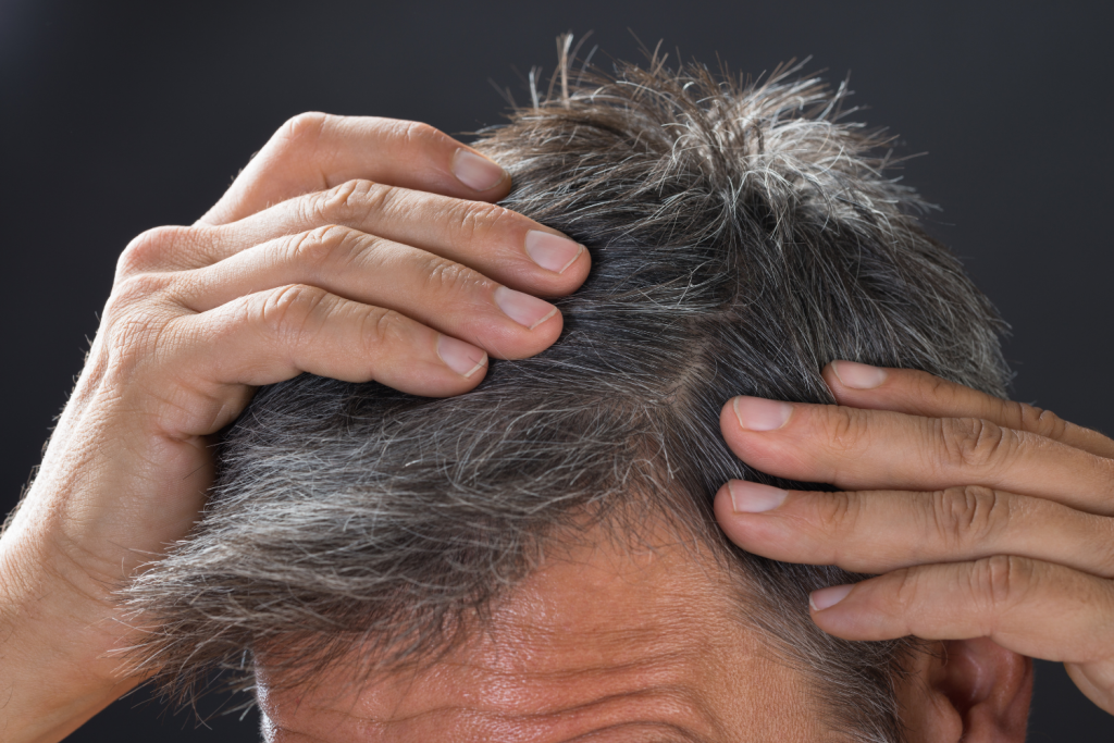 ¿Hay un medicamento que frena las canas?