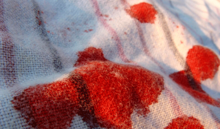 Remedios para quitar manchas de sangre