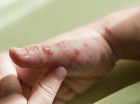 La voz de los especialistas