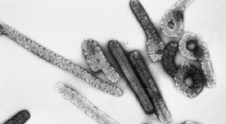 Estas son las enfermedades que tienen una larga agonía hasta matarte