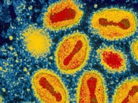 enfermedades-viruela Estas son las enfermedades que tienen una larga agonía hasta matarte