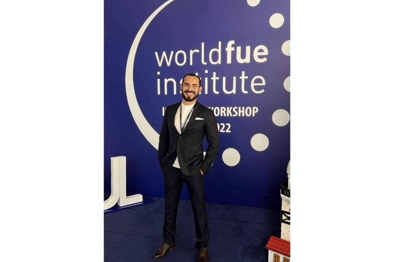 ¿Cuáles son los principales beneficios de la técnica FUE de cirugía capilar?